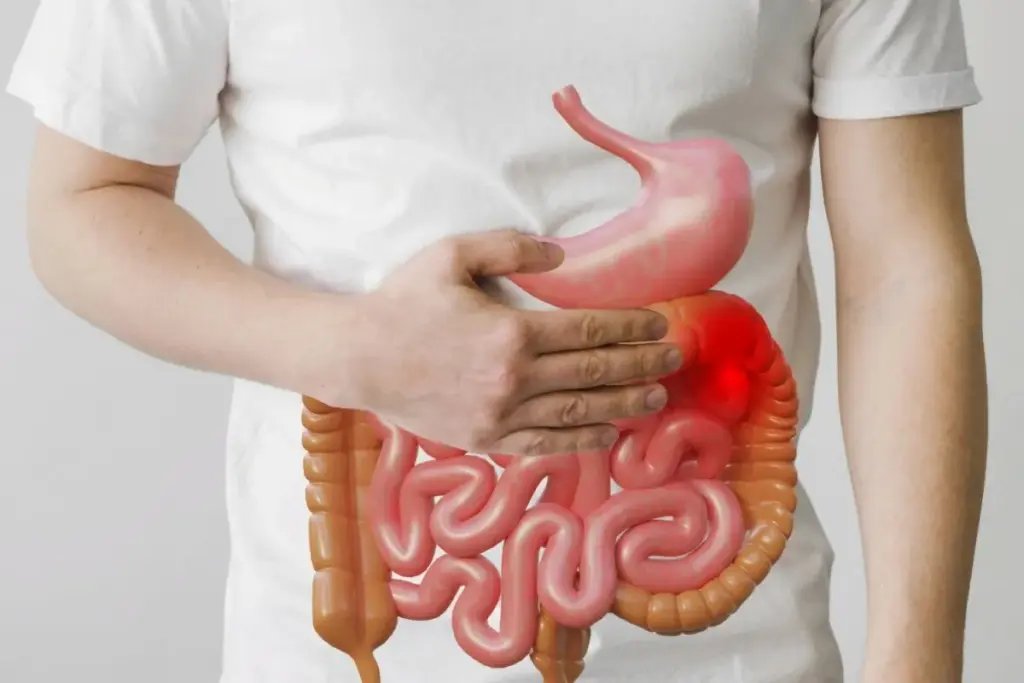 Colon Cancer Kept Away for 3 Years
